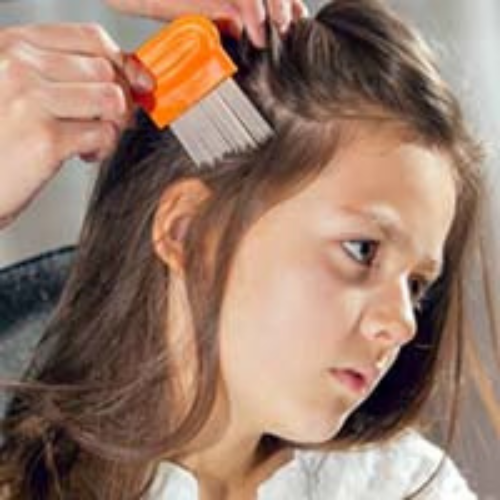 ANTI LICE products by theLabon-The best compounding pharmacy in Pakistan
