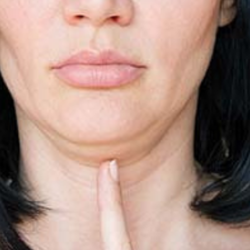 DOUBLE CHIN solution by the labon. The only GMP certified compounding pharmacy in Pakistan.
