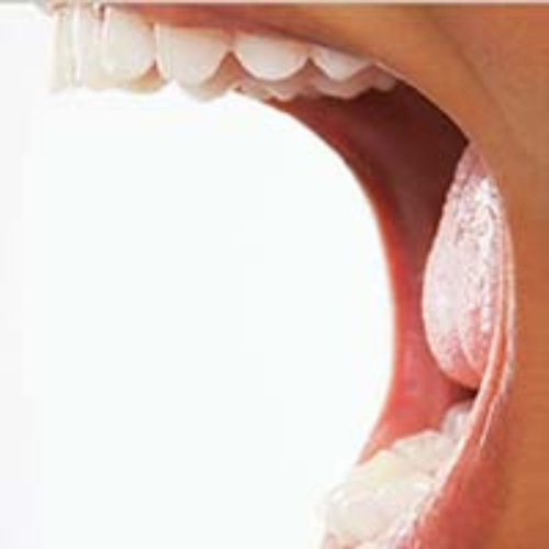 DRY MOUTH