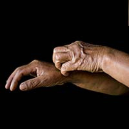 DRY SKIN treatment in hospice patients