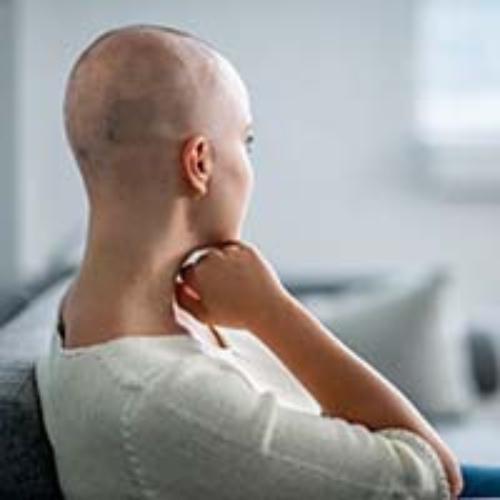 HAIR FALLING particularly in cancer patients is cured sucessfully by the Labon compounding pharmacy in Pakistan