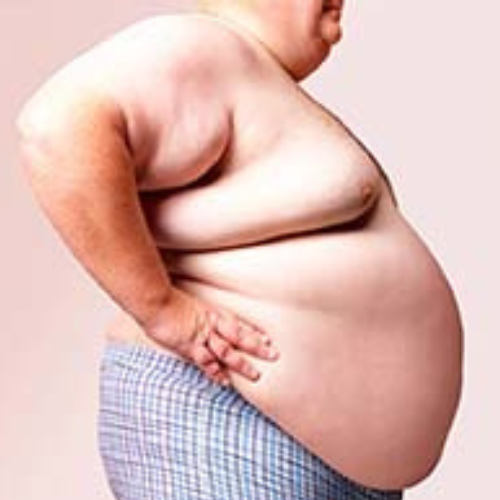 OBESITY solution by the labon. A GMP certified only compounding pharmacy in Pakistan
