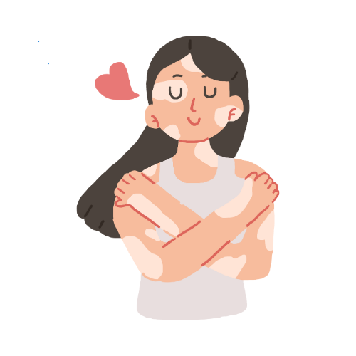 Vitiligo Treatment with Compound Glycyrrhizin and Fractional Laser