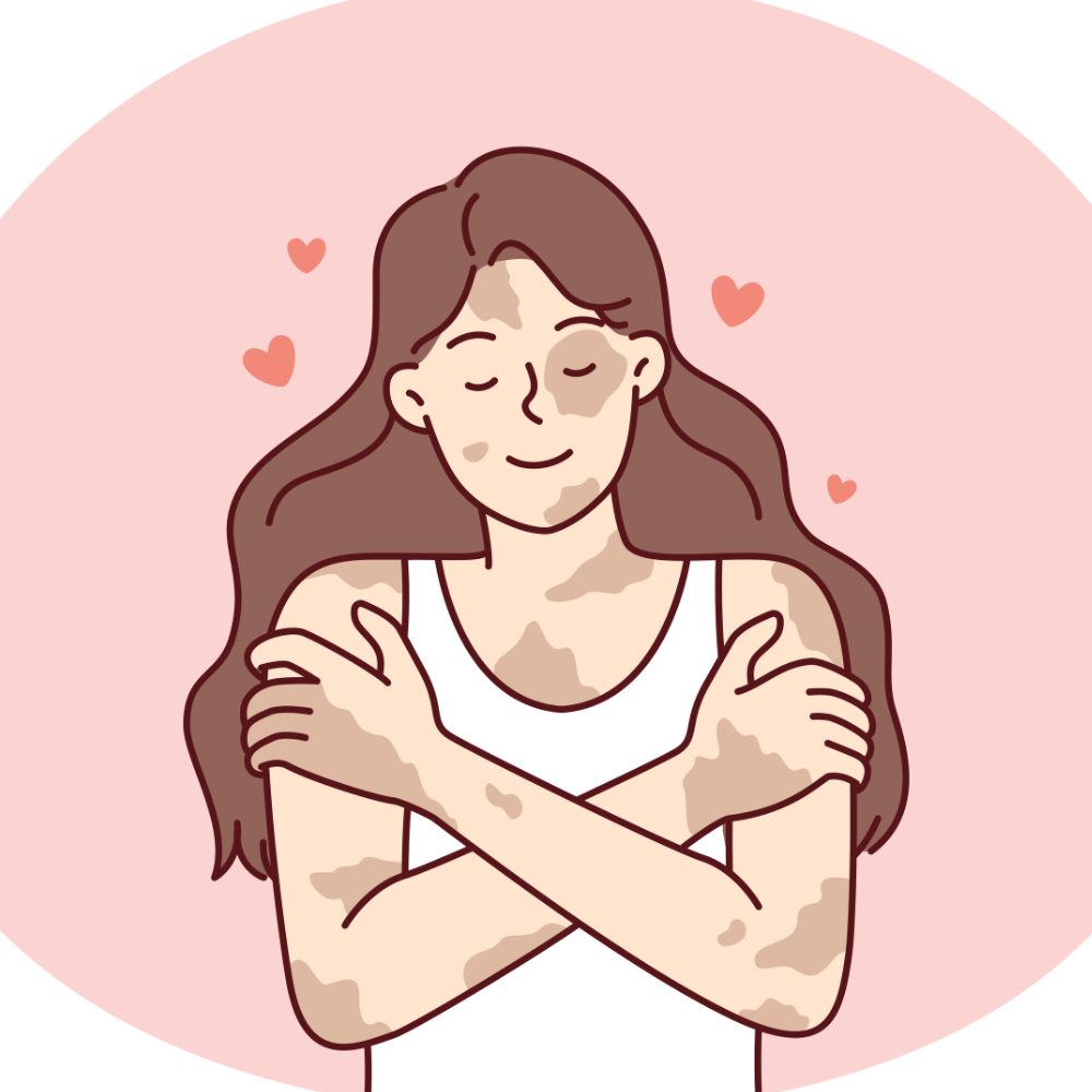 vitiligo treatment in Pakistan